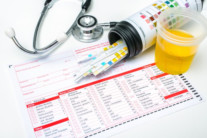 Biologische monitoring - PreventPartner